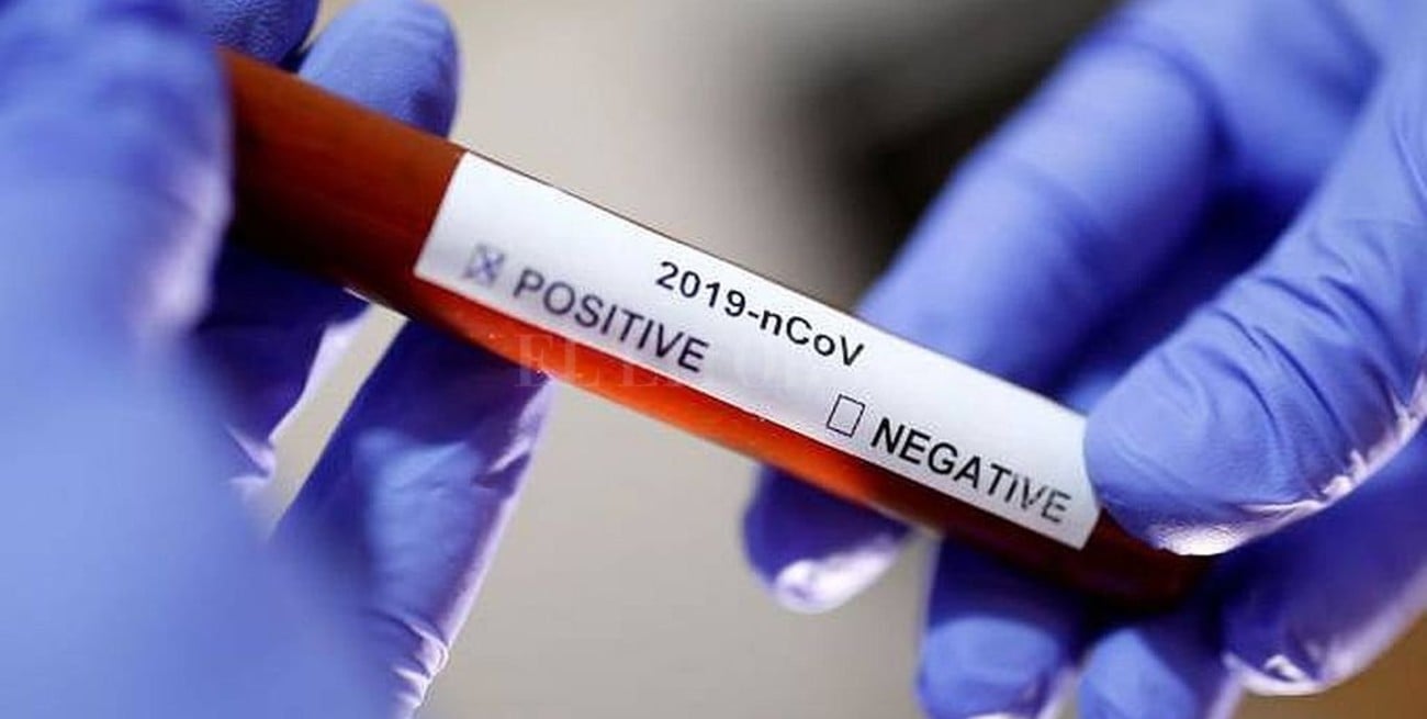 Confirman el segundo caso de coronavirus en Brasil 