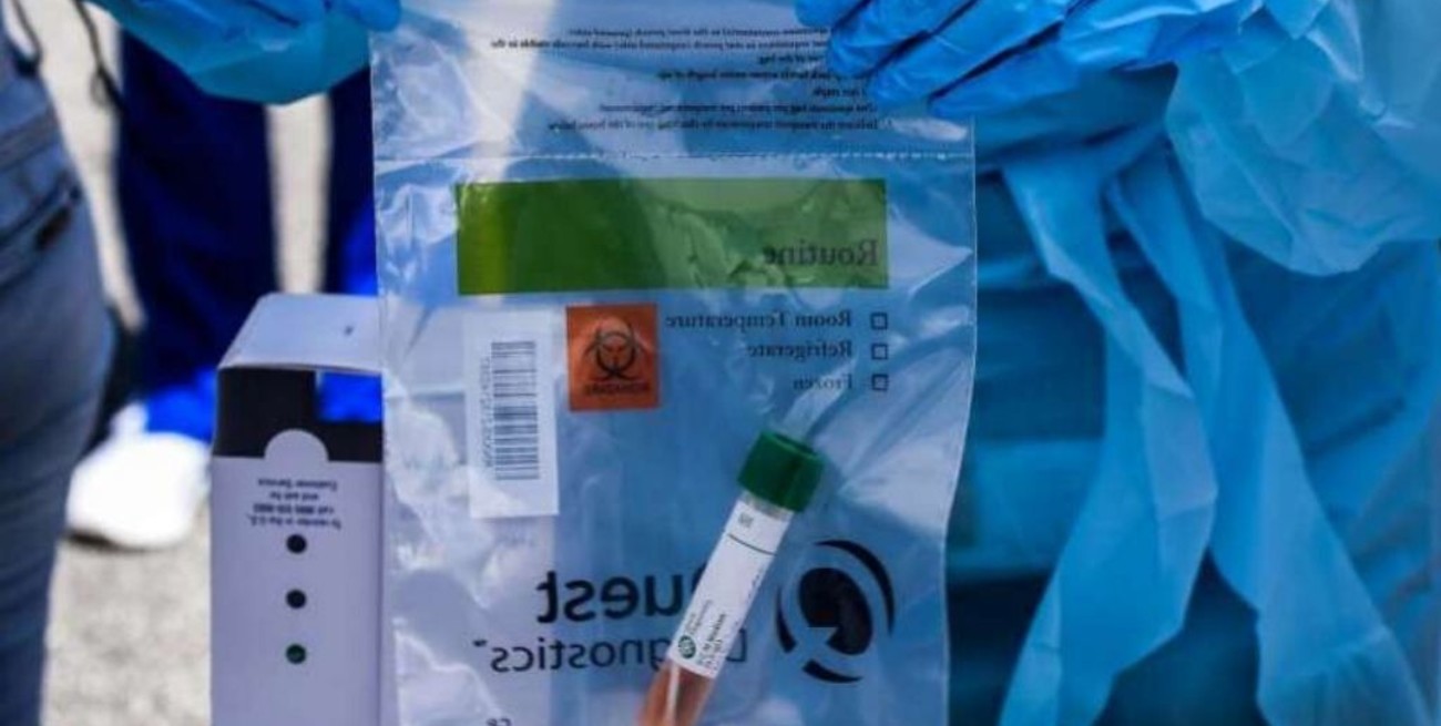 Llegan a Mendoza 10.000 reactivos importados de Corea del Sur para diagnóstico de coronavirus