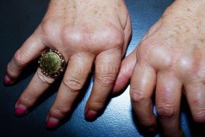 ELLITORAL_307348 |  Picture Alliance