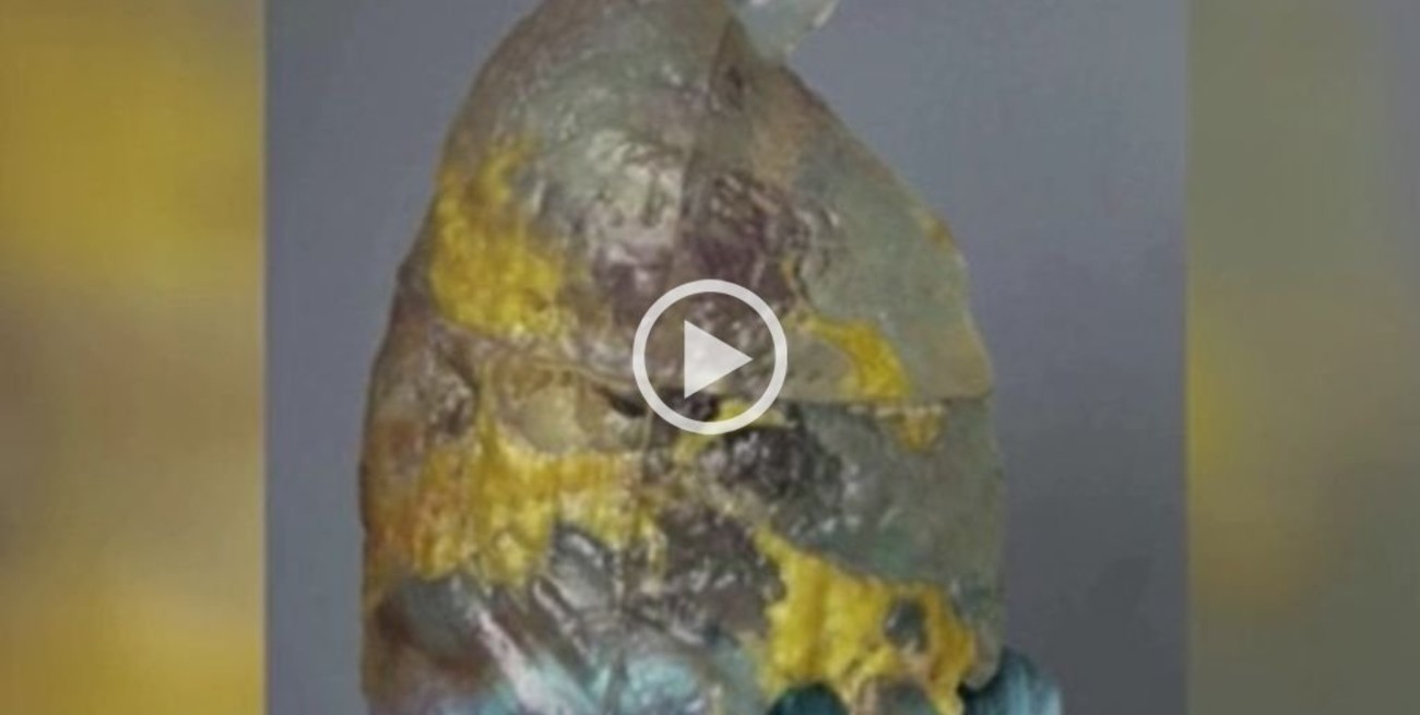 Video: así se ven impresos en 3D los pulmones con Covid-19