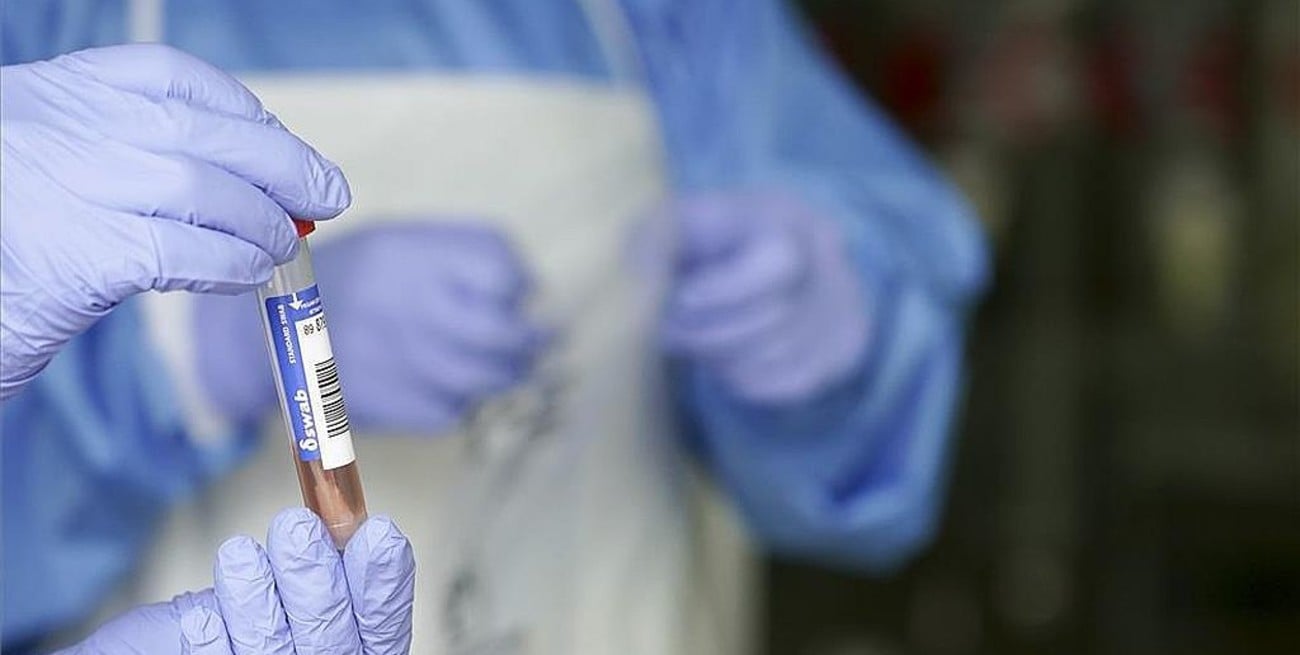 Coronavirus en Mendoza: bioquímicos alertan sobre testeos rápidos "truchos"