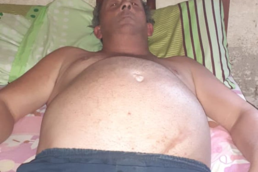 ELLITORAL_349325 |  Gentileza Claudio Fabián Sosa se encuentra postrado en una cama.