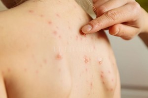 ELLITORAL_272889 |  Gentileza