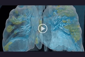 ELLITORAL_292762 |  Captura de pantalla