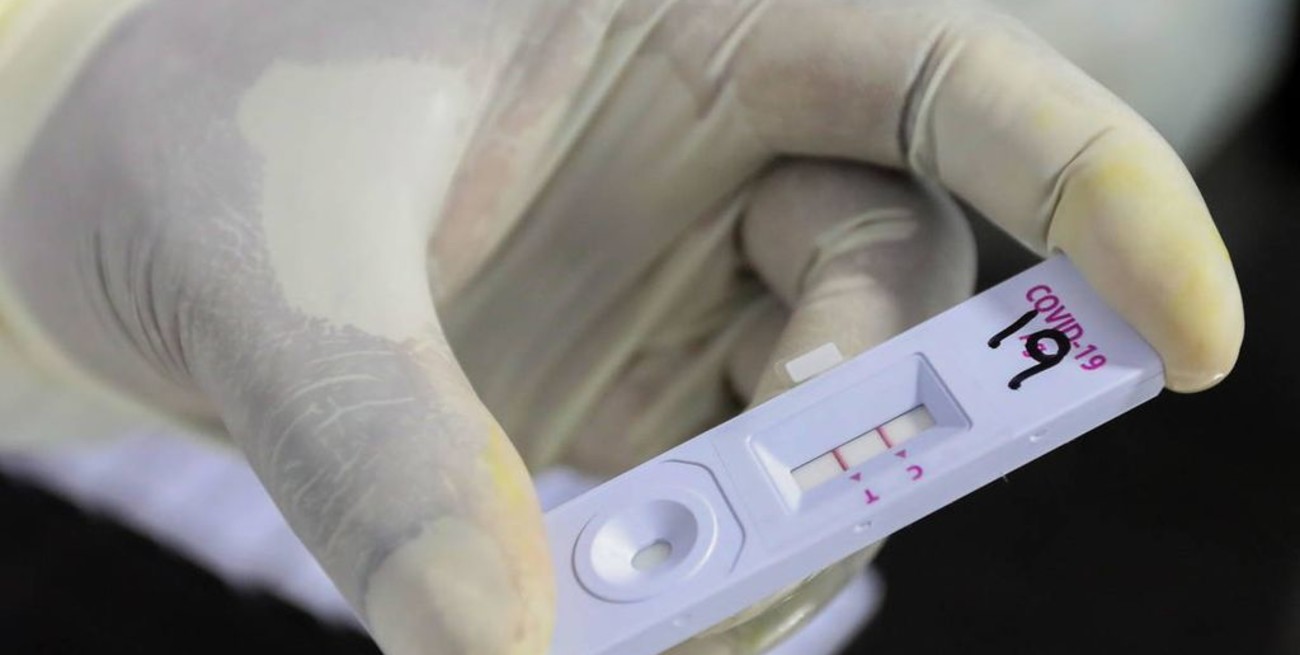 Llegaron a Argentina 2,2 millones de test para la detección rápida de coronavirus