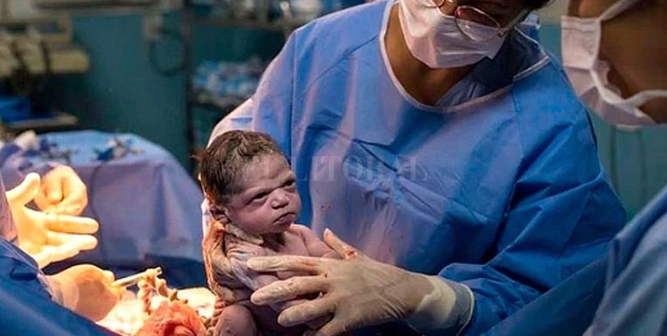 Viral: en Brasil nació una bebé "enojada"