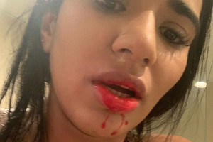 ELLITORAL_298693 |  Instagram Una de las imágenes que compartió su pareja en Instagram