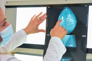 ELLITORAL_332107 |  Gentileza En el país se producen 22 mil nuevos casos de cáncer de mama y más de 6 mil muertes cada año. La prevención es fundamental.