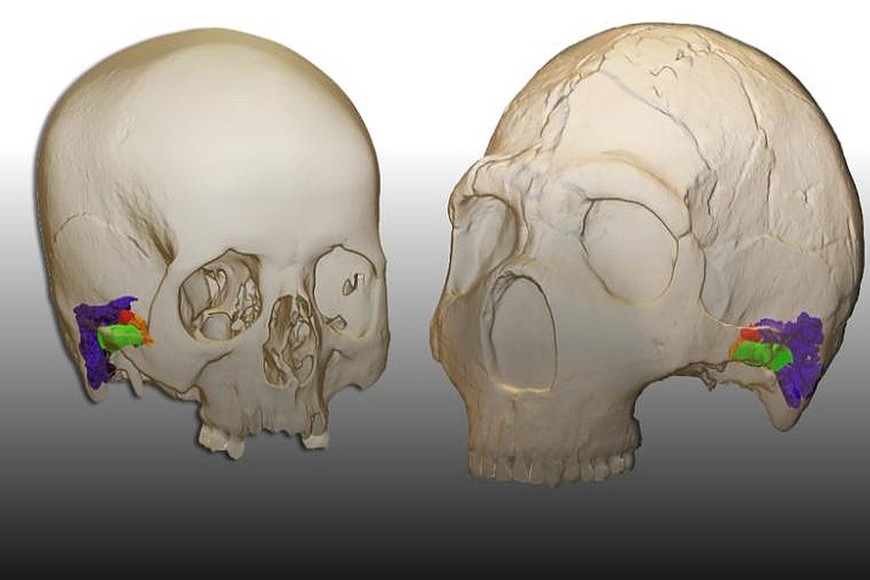 ELLITORAL_359698 |  Universidad de Alcalá Una reconstrucción virtual de la oreja en un humano moderno (izquierda) y un cráneo de neandertal. Saber si los neandertales y otros antepasados humanos eran capaces de un lenguaje hablado sofisticado ha sido un tema de debate de larga data en la evolución humana.