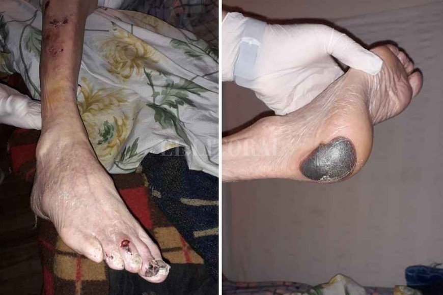 ELLITORAL_420239 |  Gentileza La ex empleada que denunció al geriátrico tildó de  deplorable  el estado de los ancianos.