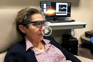 ELLITORAL_412626 |  Captura digital La mujer que recibió el implante había perdido la vista hace 16 años.