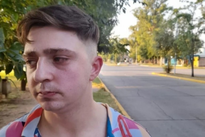 ELLITORAL_431013 | Gentileza Así quedó el rostro del joven agredido.