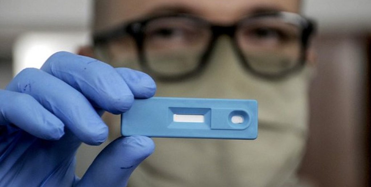 La ANMAT aprobó el test argentino para la detección rápida de coronavirus