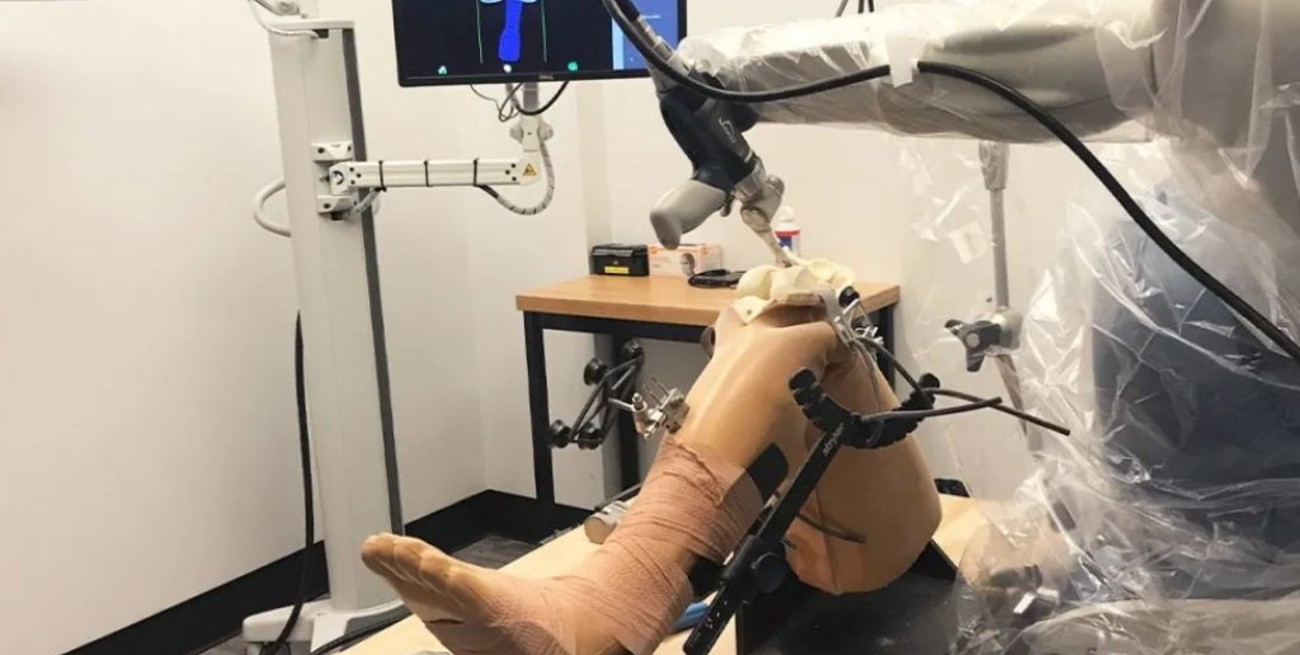 Realizan un reemplazo total de rodilla con tecnología robótica en el país