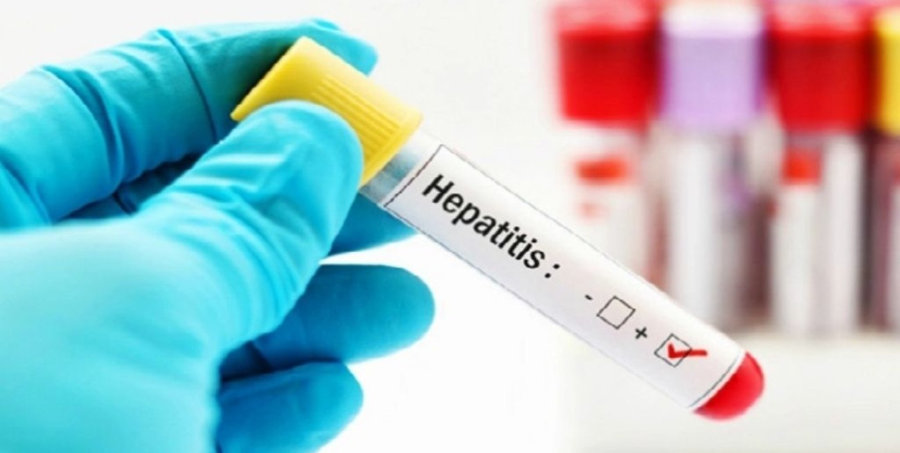 Método para prevenir las hepatitis víricas