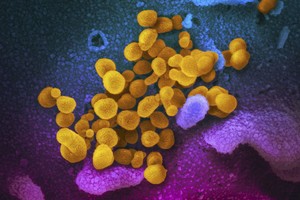 ELLITORAL_425298 |  AP El coronavirus, en amarillo, en una imagen microscópica.