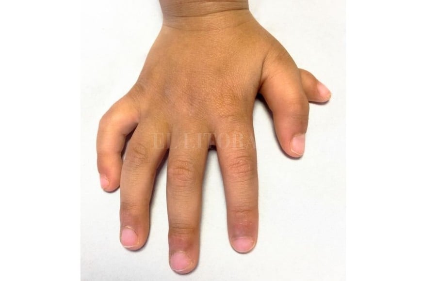 ELLITORAL_369841 |  Archivo El sexto dedo de la mano de  Zaid .