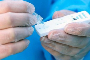 El Litoral El resultado se obtiene en unos 10 minutos.