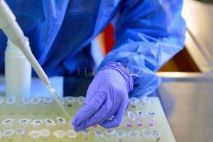 ELLITORAL_401615 |  Gentileza Laboratorio de Córdoba.