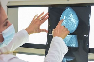 ELLITORAL_409038 |  Archivo El principal riesgo de tener cáncer de mama es ser mujer , sostuvo la directora de la Agencia de Control de Cáncer, Graciela López, e insistió en la importancia de los controles periódicos.