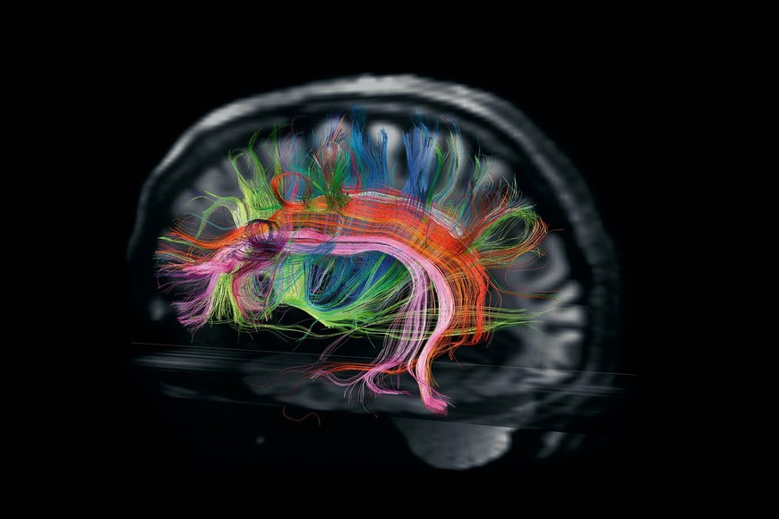 ELLITORAL_419259 |  Van Wedeen y L. L. Wald, Centro de Imágenes Biomédicas Martinos, Proyecto Conectoma Humano.