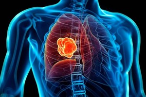 ELLITORAL_418771 |  Gentileza