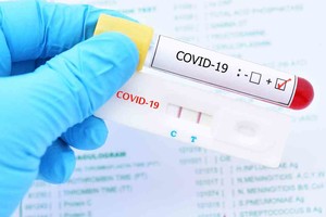 ELLITORAL_410861 |  Imagen ilustrativa Positive test result by using rapid test device for COVID-19 virus, novel coronavirus 2019 found in Wuhan, China