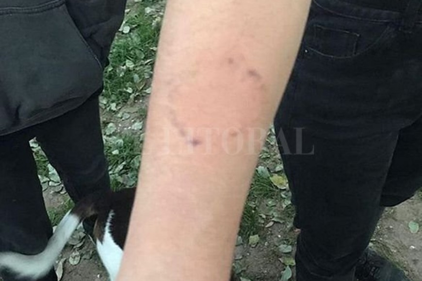 ELLITORAL_218987 |  Instagram Juntas y a la Izquierda Una de las manifestantes fue mordida en el brazo por uno de los agresores.