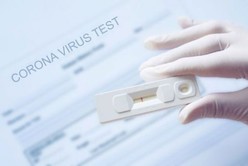 Córdoba pidió que ANMAT apruebe el uso de autotest para diagnosticar coronavirus