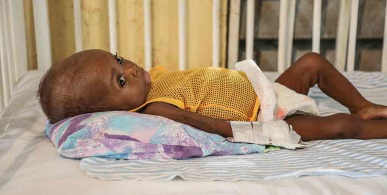 Cerca de 200 niños murieron de hambre en hospitales de Etiopía