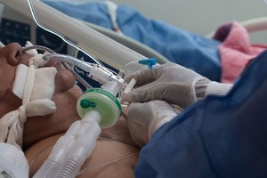 ELLITORAL_372954 |  Telam Las terapias intensivas de los hospitales están al límite. Las medidas propuestas por la SAV son para reducir la cantidad de internaciones.