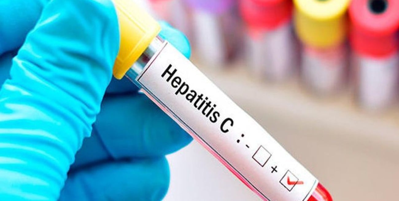 19 de Mayo: Día Mundial contra la Hepatitis C