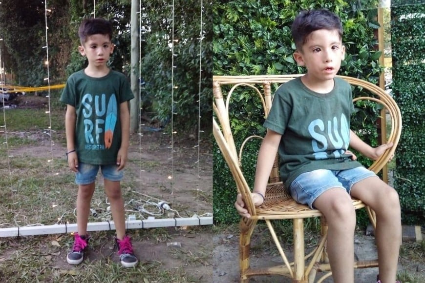 ELLITORAL_432435 |  Gentileza Benizio, niño con Síndrome de Moebius. No sonríe con el rostro, lo hace con el alma y el corazón.