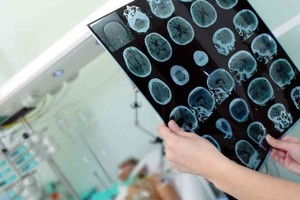 ELLITORAL_435273 |  Imagen Ilustrativa D.R