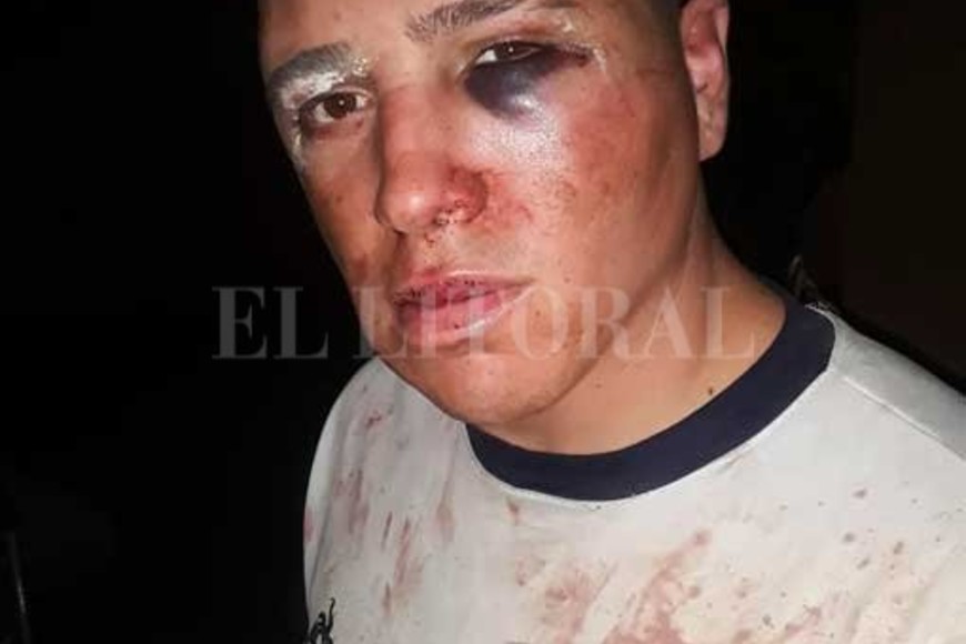 ELLITORAL_424811 |  Gentileza La peor parte de la golpiza se la llevó un muchacho que terminó inconsciente, con hemorragias y una fractura en el pómulo.