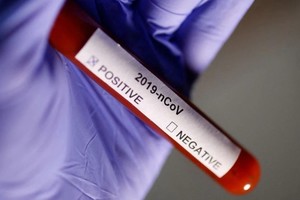 ELLITORAL_433455 |  Reuters El tubo de ensayo con la etiqueta Coronavirus se ve en esta ilustración tomada el 29 de enero de 2020.