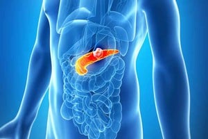 Imagen Ilustrativa D.R