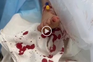 Captura de video D.R