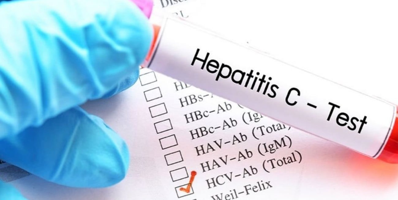 Se aprobó un test rápido para la detección de la hepatitis C