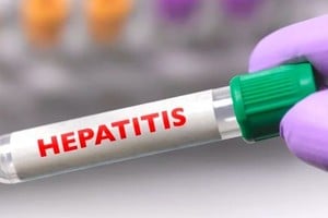 Los virus principales de hepatitis son 5: A, B, C, D y E, y representan un problema mundial de salud pública debido a los brotes y propagación epidémica que pueden provocar.