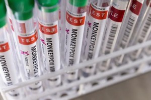 Las muestras se enviarán al Instituto Malbrán para su análisis.