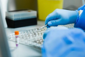 De acuerdo a los datos difundidos, la cantidad de muertes descendió 27,7% en relación a la semana pasada cuando se habían informado 54 fallecimientos.