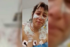 La mujer terminó con lesiones en diversas partes de su cuerpo.