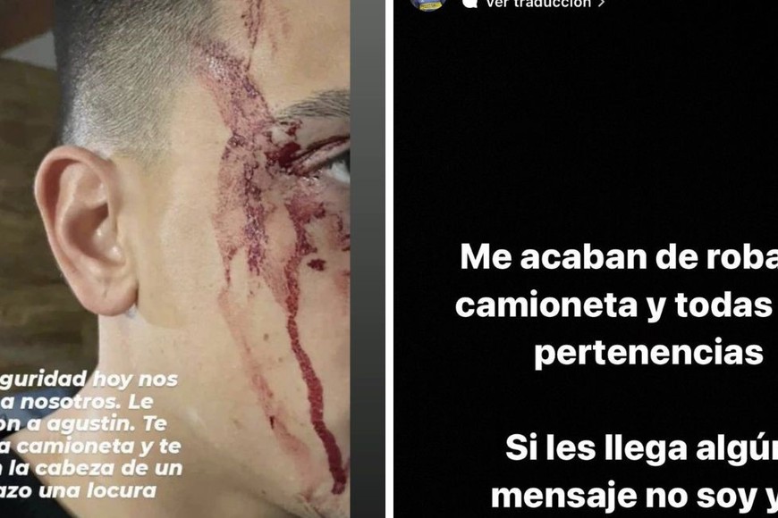 El jugador de Boca le pegaron en el rostro y le robaron una camioneta.