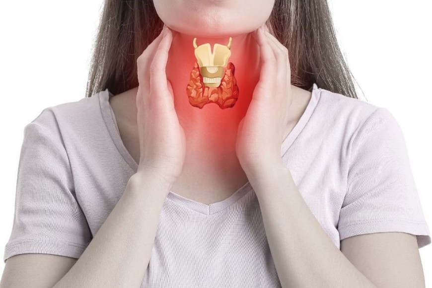 Unas 750 millones de personas en el mundo padecen de alguna patología tiroidea. Crédito: Gentileza