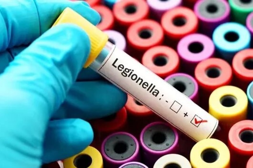 legionella