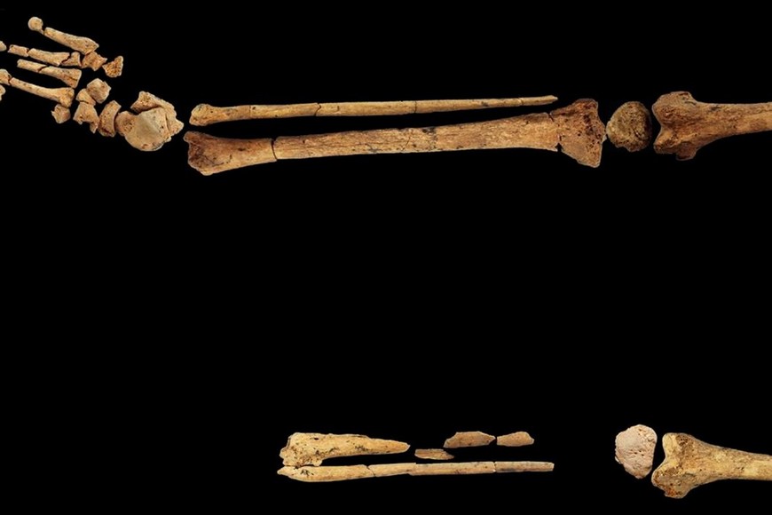 En el miembro cercenado se puede observar “en el colágeno que envuelve los huesos lo que son señales características que indican que ya está cicatrizado”