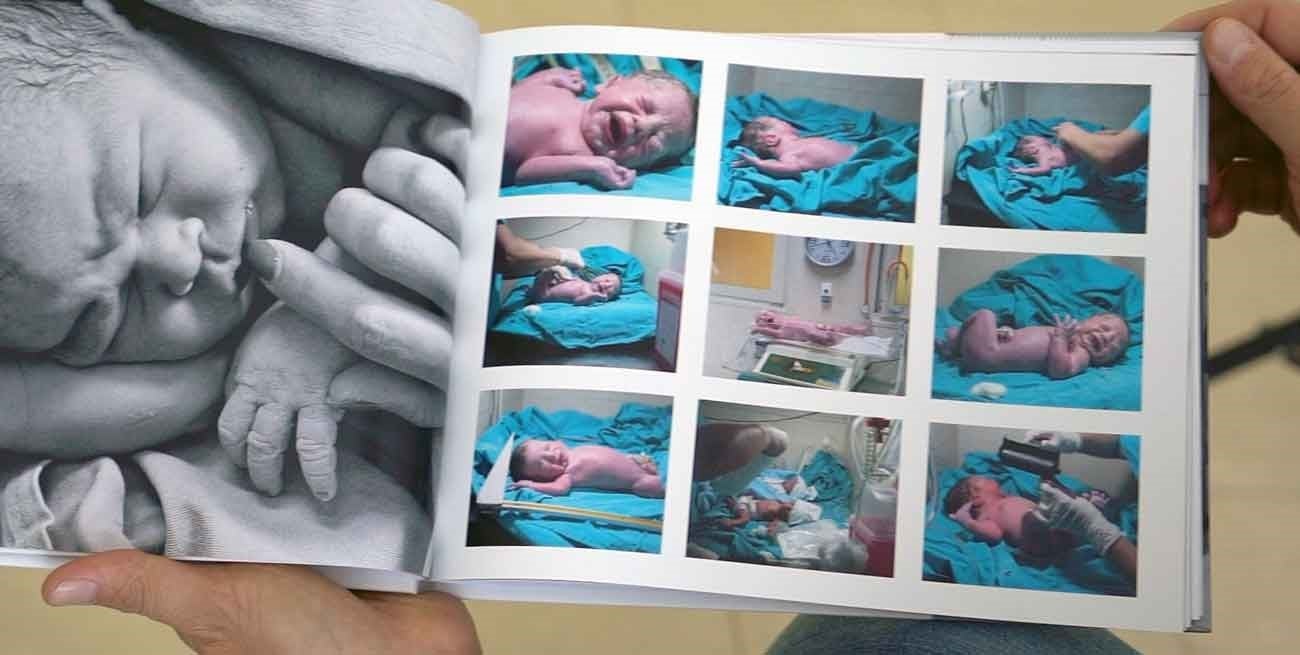 "El milagro de la vida": la emotiva tarea de fotografiar el nacimiento
