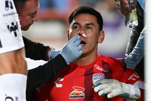 Oscar Ustari terminó golpeado tras hacer el penal.