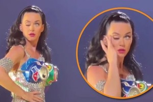 La artista estadounidense perdió el control de uno de sus párpados durante un show en Las Vegas